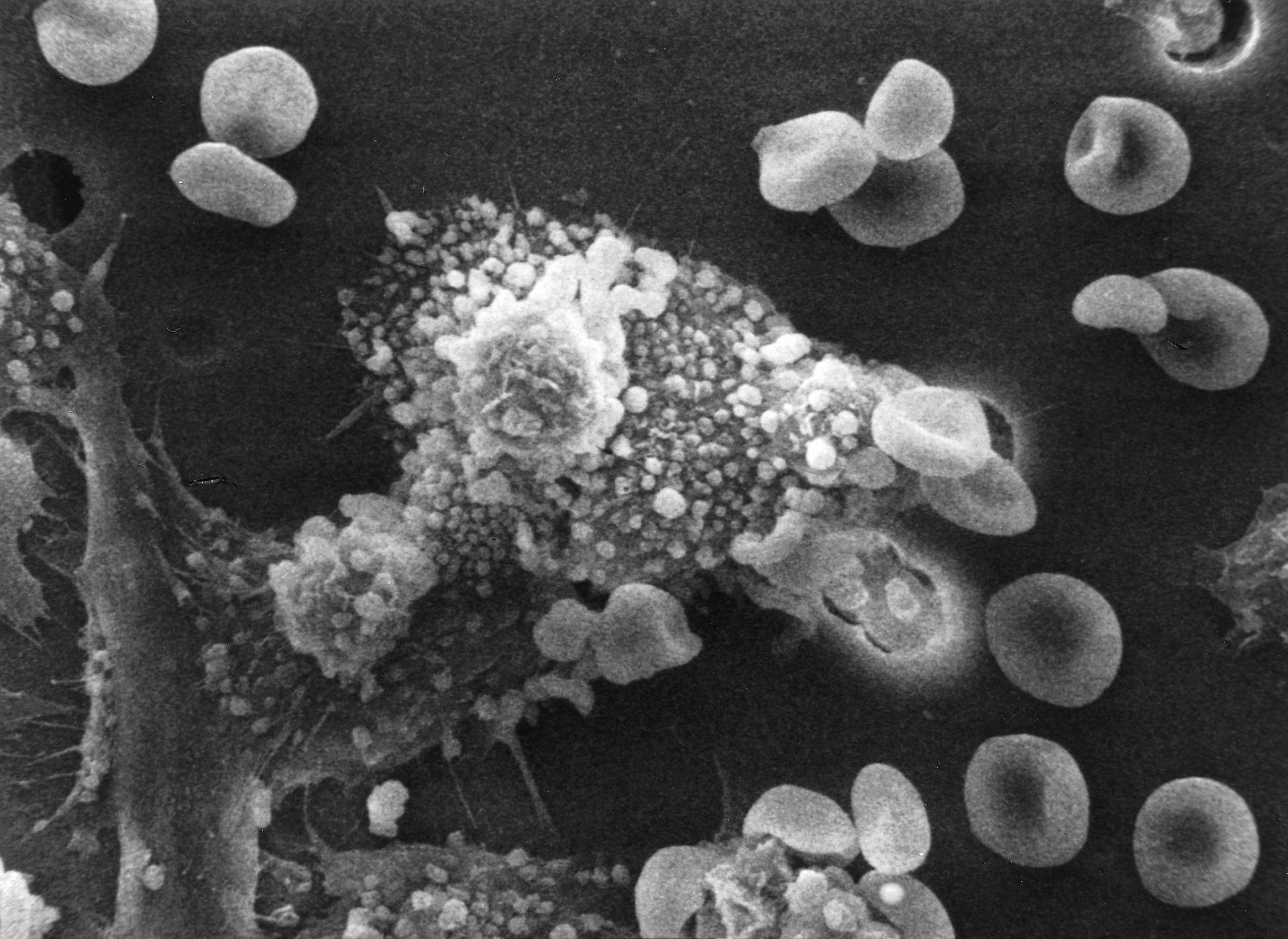 Macrophages attacking cancer cell