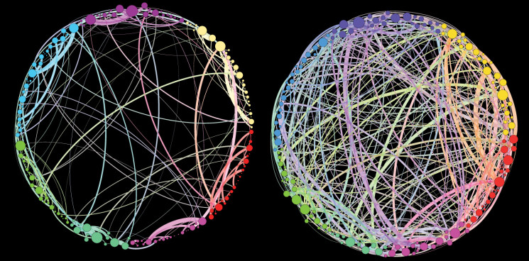 lsd brain interconnectivity